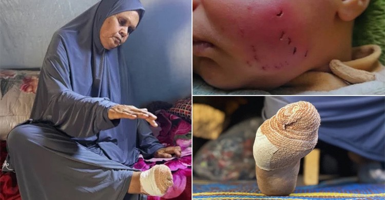 গাজায় ঘুমন্ত মানুষের শরীর কামড়ে খাচ্ছে ইঁদুর