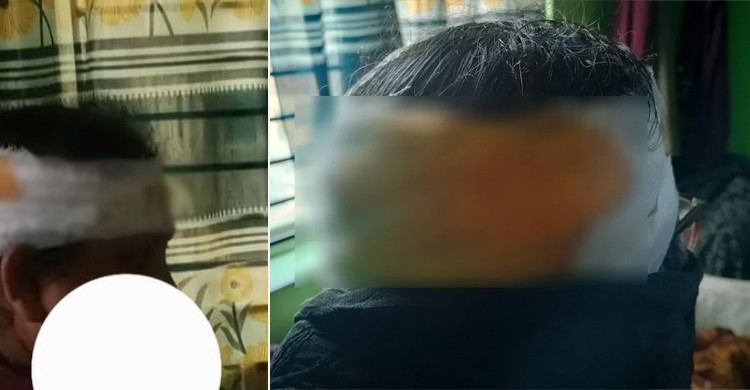 গণসংযোগকালে জামায়াতের নারী নেত্রীর ওপর রামদা দিয়ে যুবদলের হামলার অভিযোগ